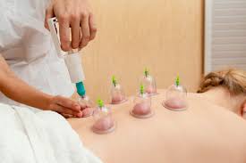 Dry Needling & Cupping